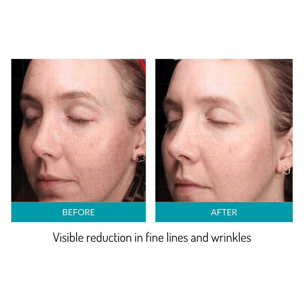 Glo Mask Anti-Aging LED Phototherapy Mask