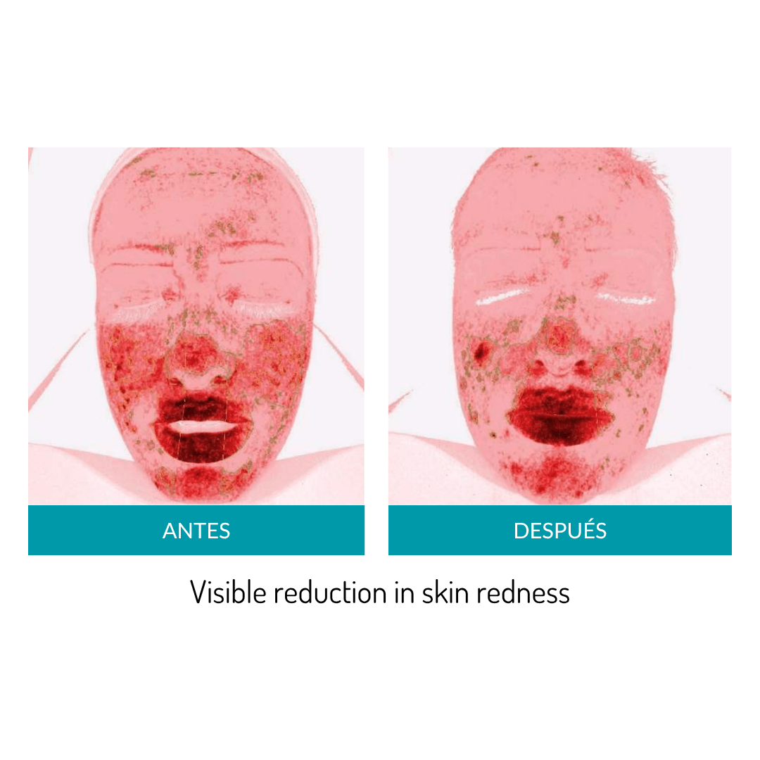 Glo Mask Anti-Aging LED Phototherapy Mask