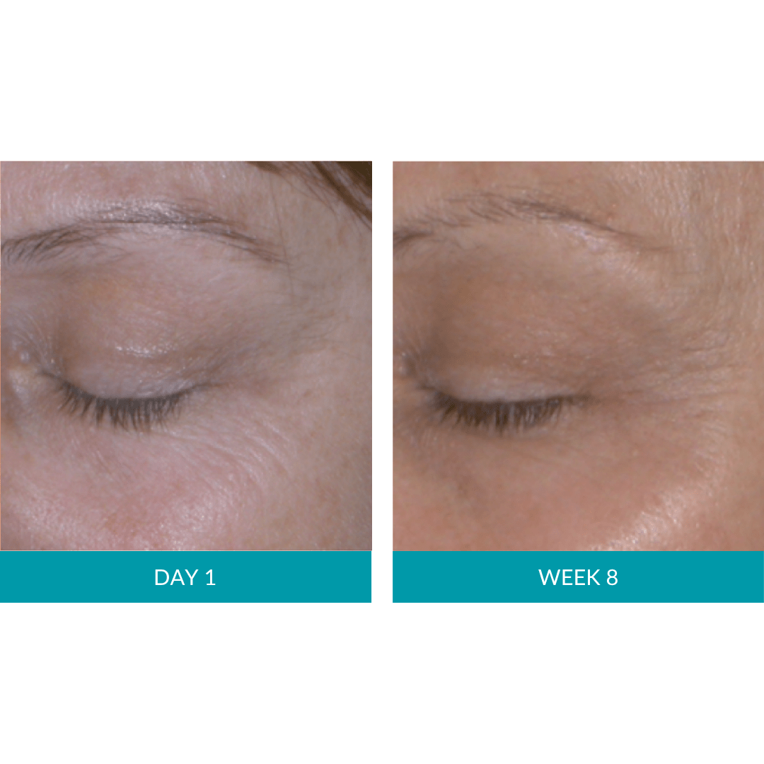 Glo Mask Anti-Aging LED Phototherapy Mask